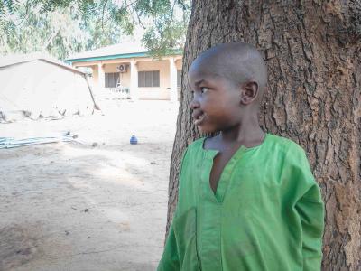 Yusufa Adam, 5 years, received treatment for noma in the Sokoto hospital.