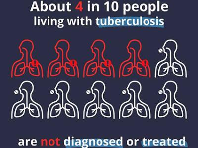 About 4 in 10 people living with tuberculosis are not diagnosed or treated