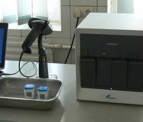 GeneXpert test technology has revolutionised the diagnosis of TB, allowing detection of the TB bacterium, and its resistance to drugs, in only two hours.